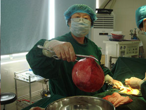 上海妇科医院治疗子宫肌瘤